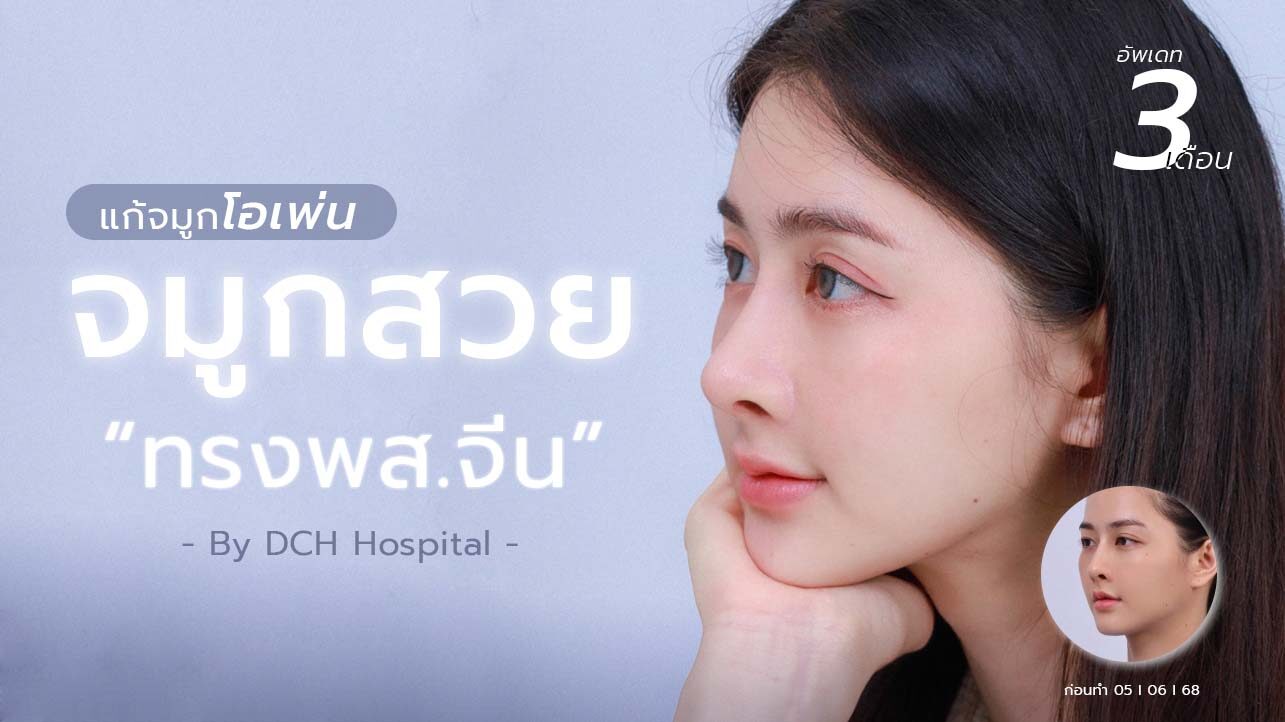 ปกบทความแก้จมูกโอเพ่นคุณวี่