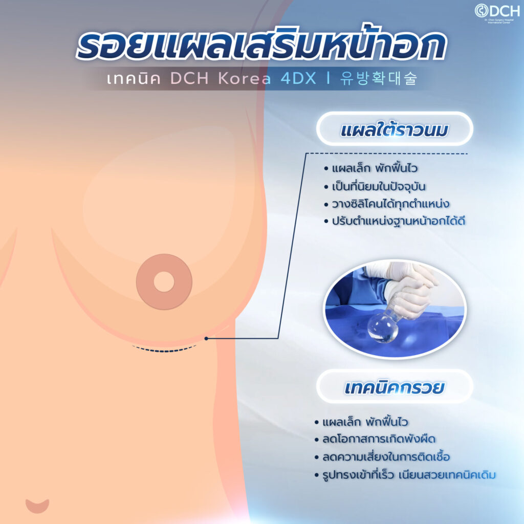 รอยแผลใต้ราวนม
