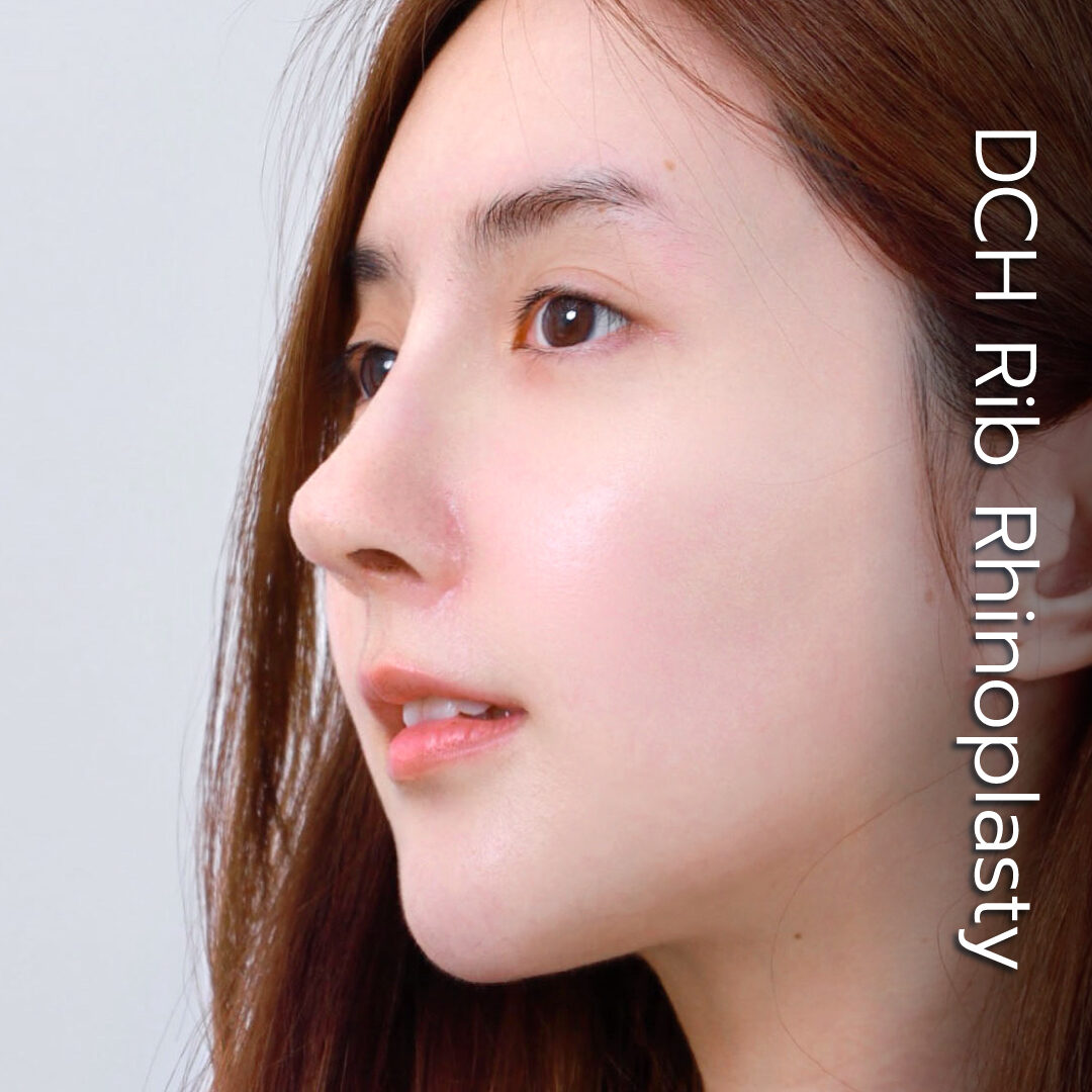 ศัลยกรรมจมูก