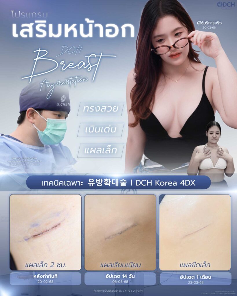 หน้าอก-มีนา-01