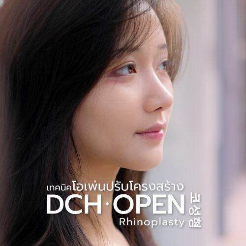DCH OPEN Rhinoplasty