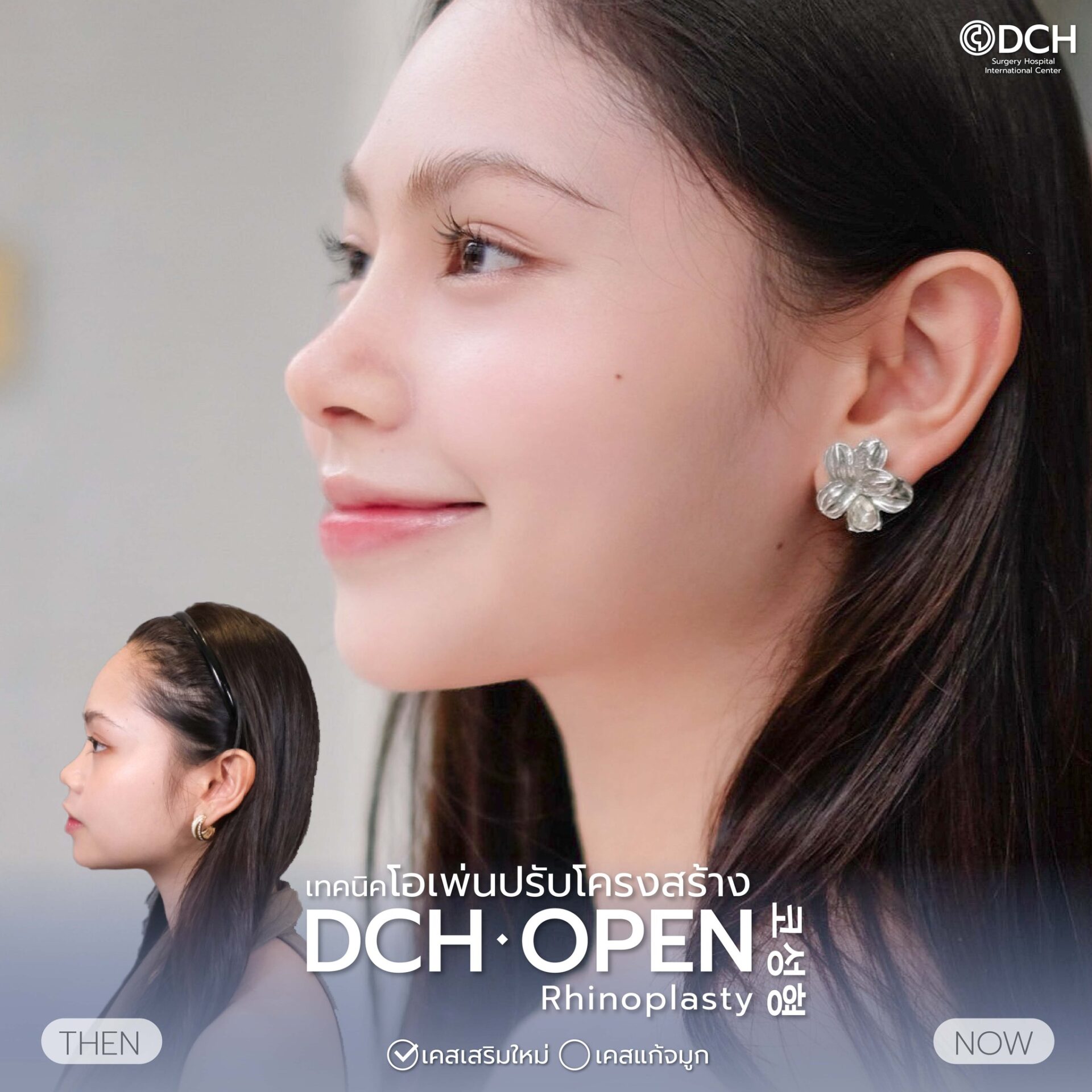 เสริมครั้งแรก