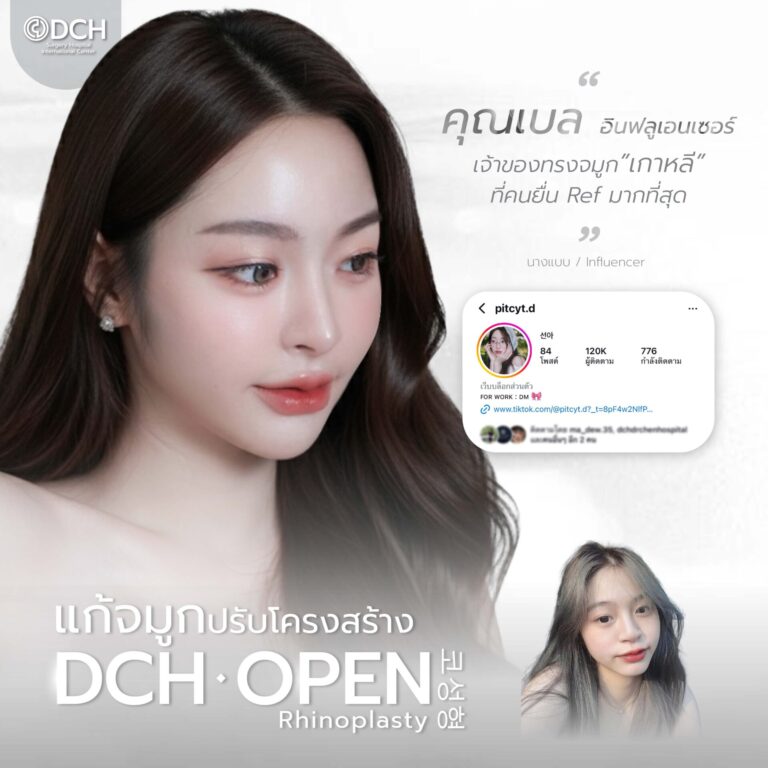 คนดัง จมูก-01
