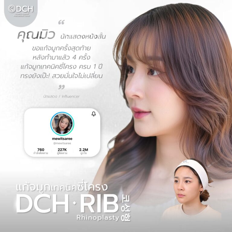 คนดัง จมูก-03