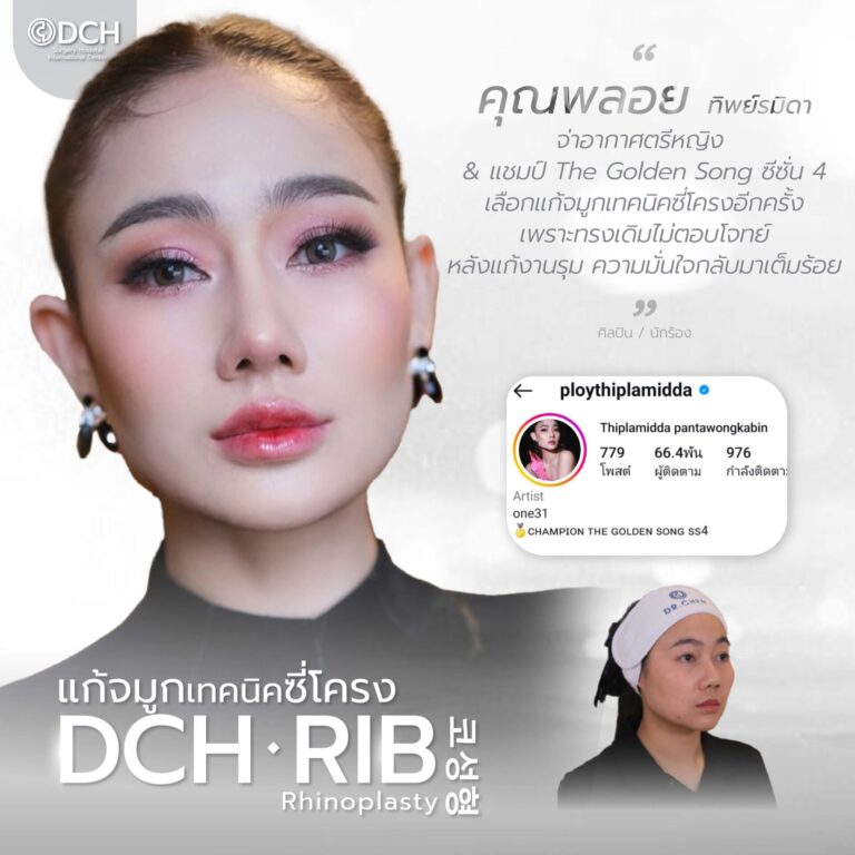 คนดัง จมูก-04