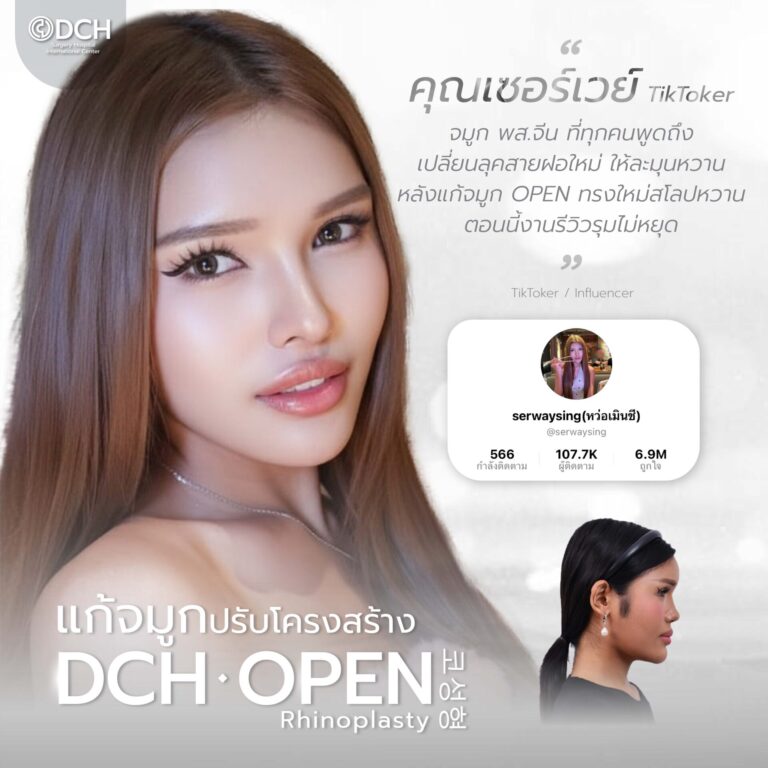 คนดัง จมูก-07