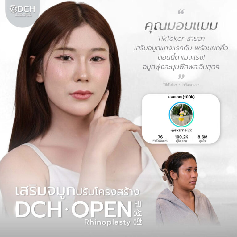 คนดัง จมูก