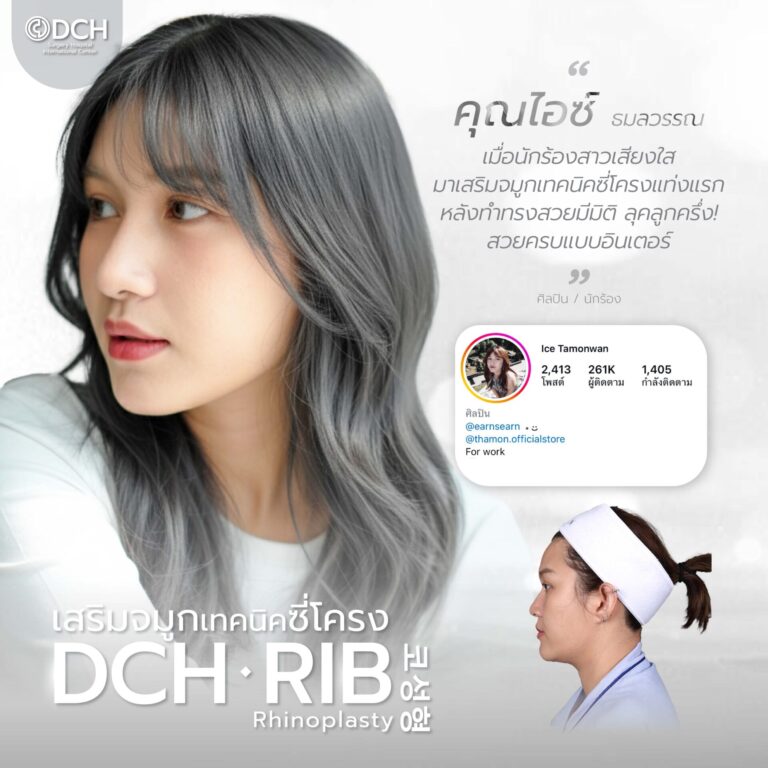 คนดัง จมูก-13