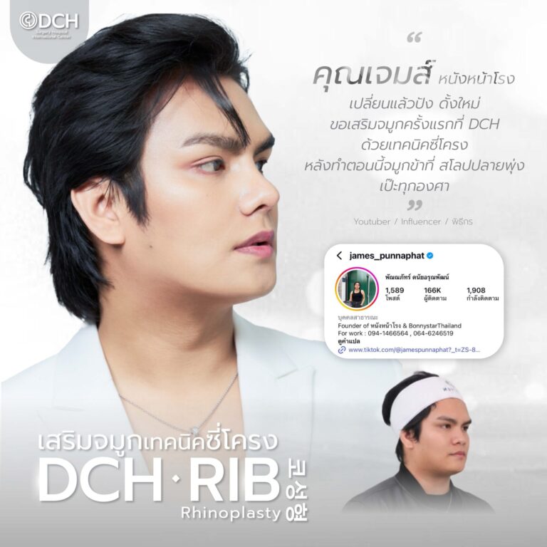 คนดัง จมูก-14