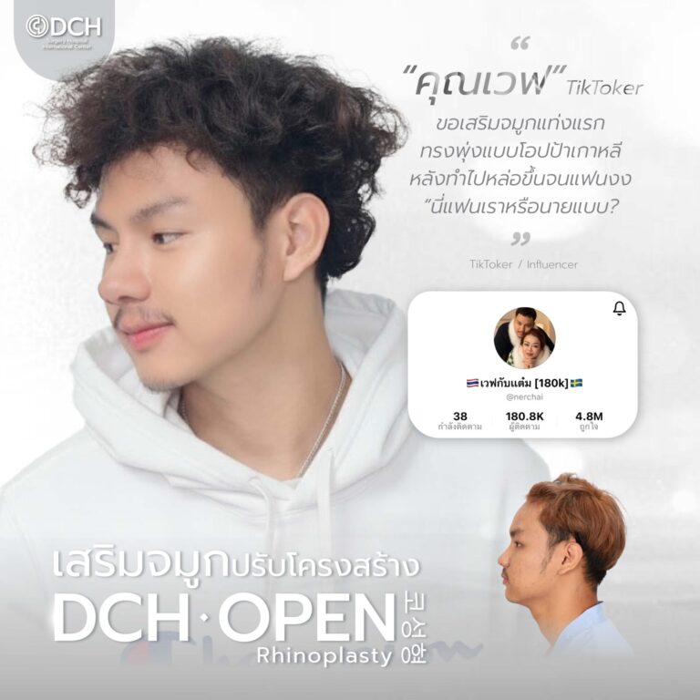 คนดัง จมูก-17