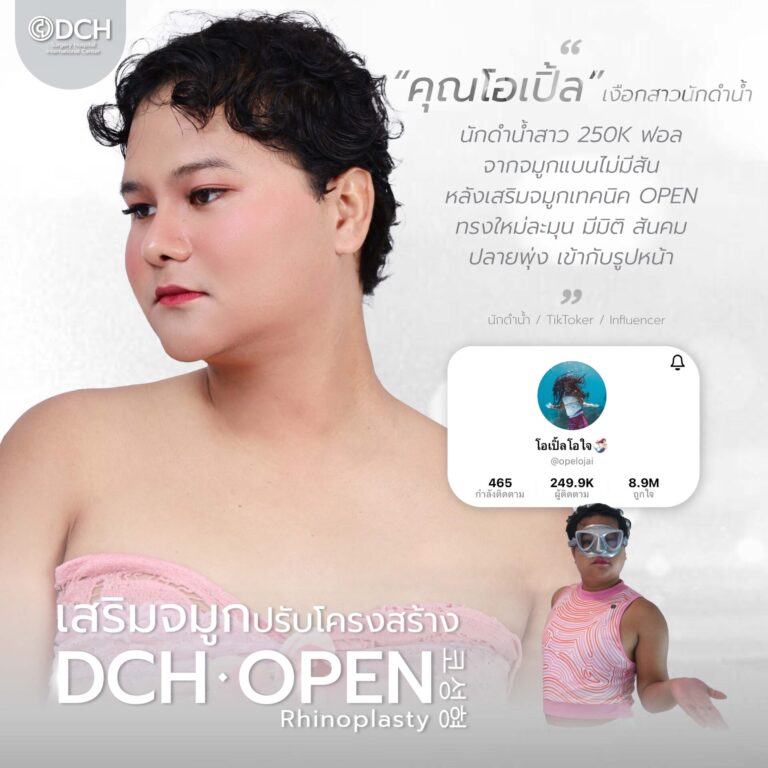 คนดัง จมูก-19