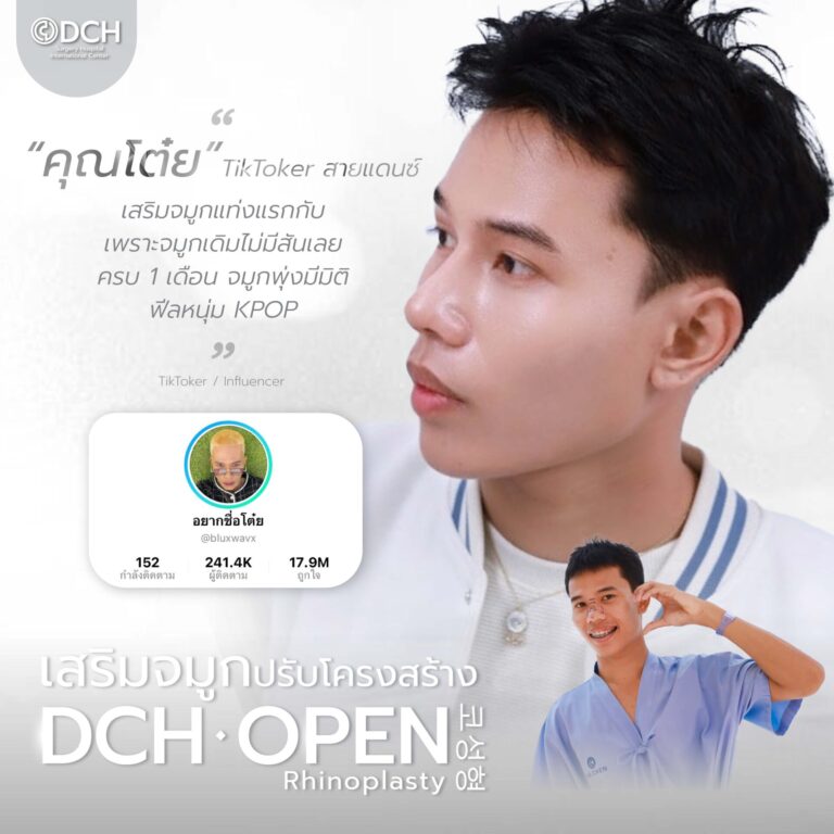 คนดัง จมูก-20