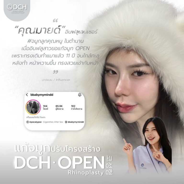 คนดัง จมูก-21