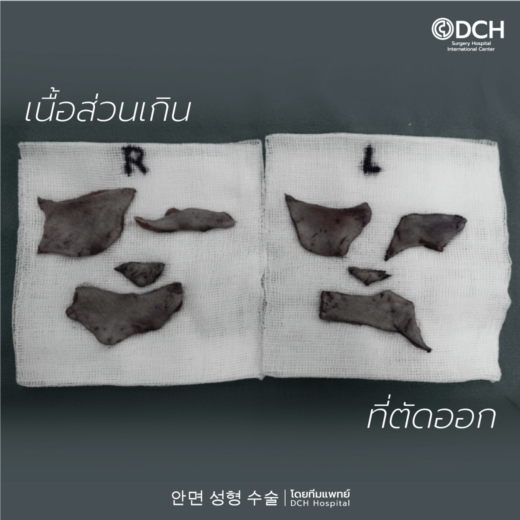 ดึงหน้าที่ไหนดี