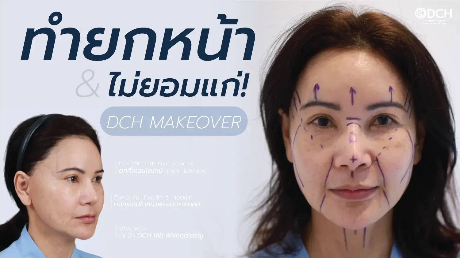 ดึงหน้า