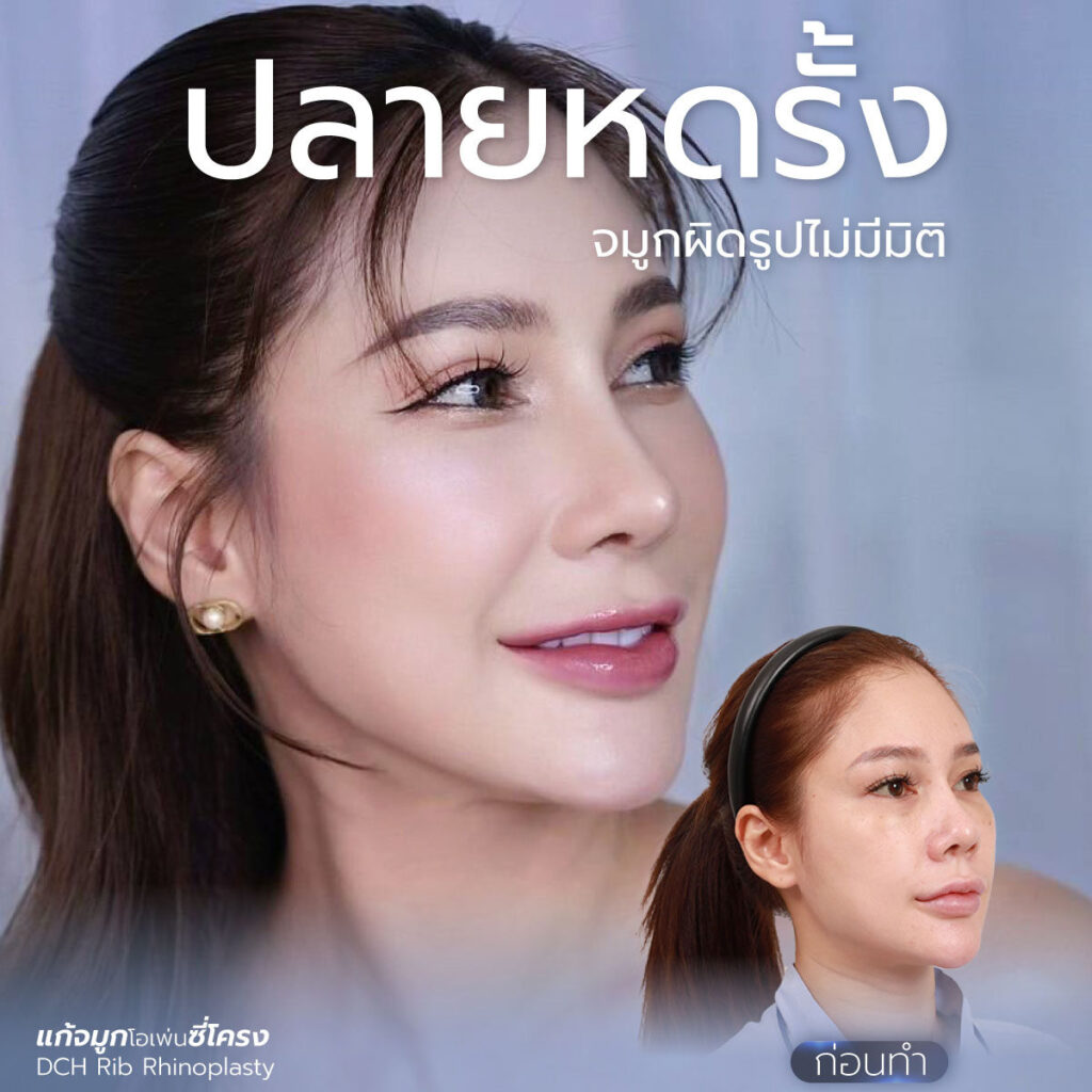หดรั้ง