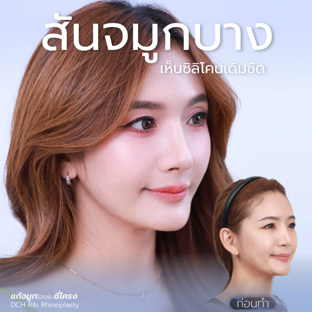 สันบาง