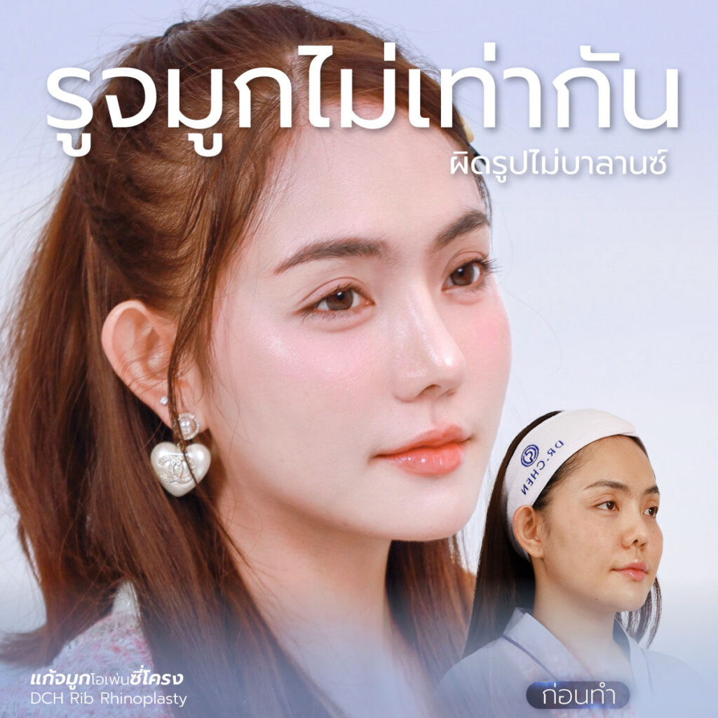 รูไม่เท่า