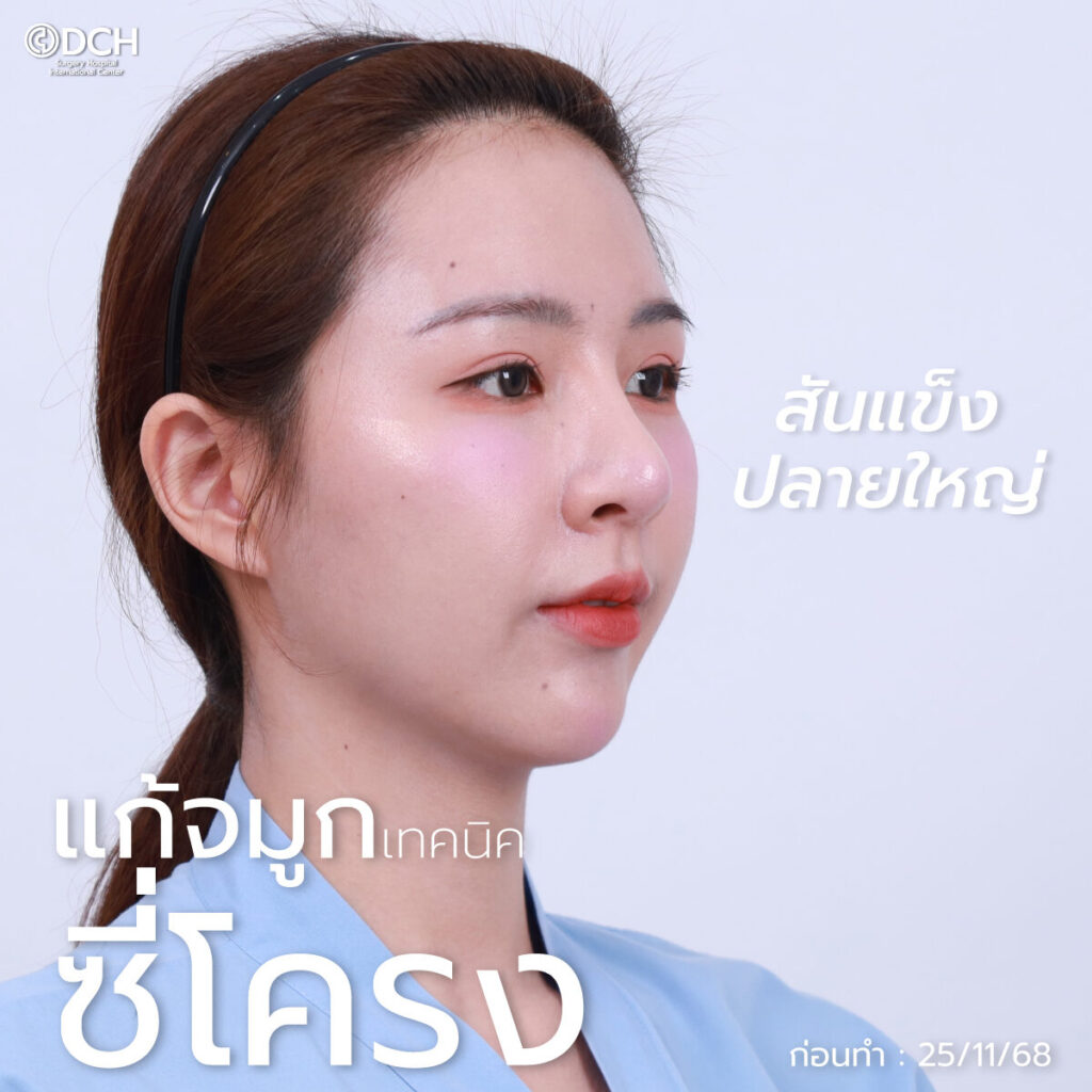 ซี่โครง