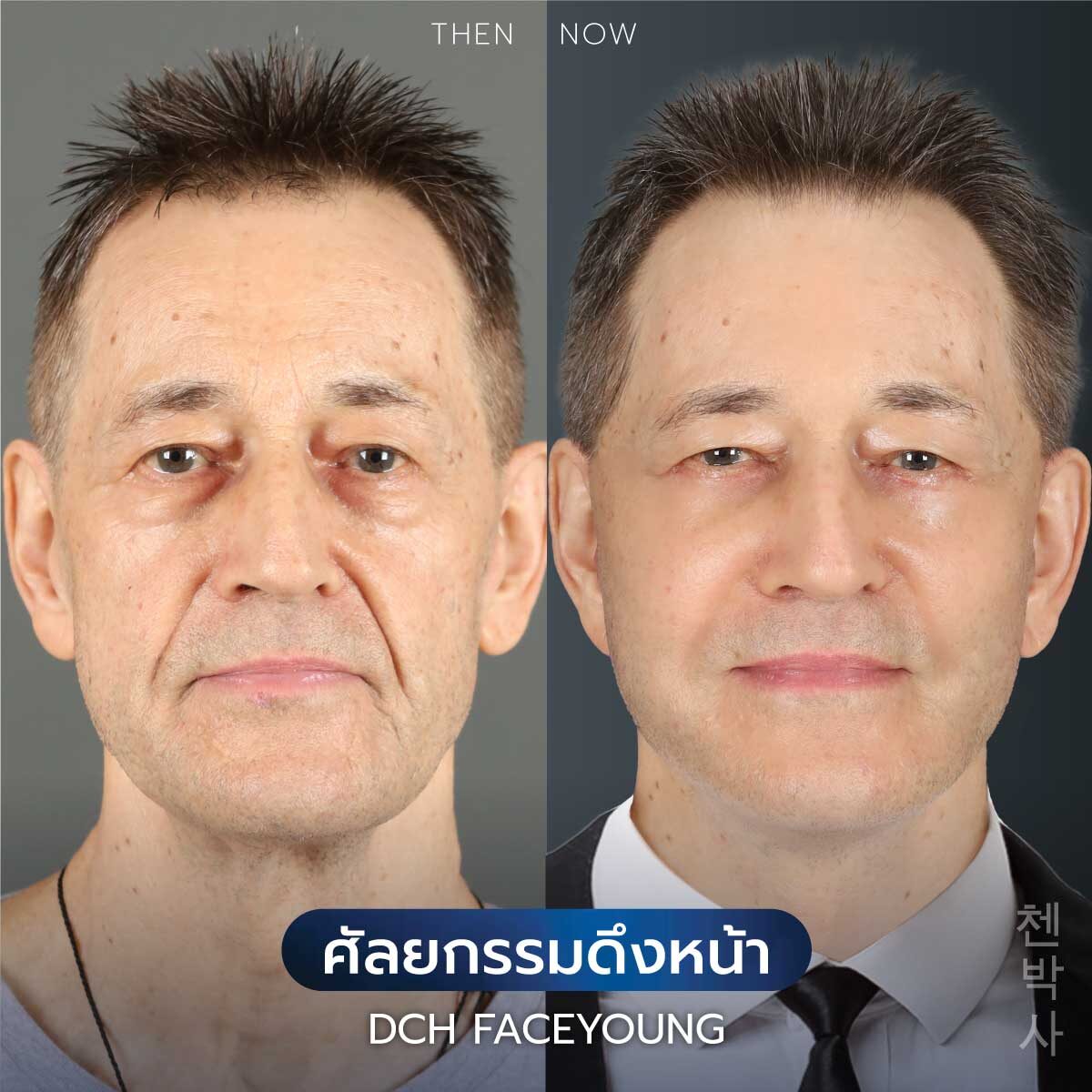 ดึงหน้าผู้ชาย