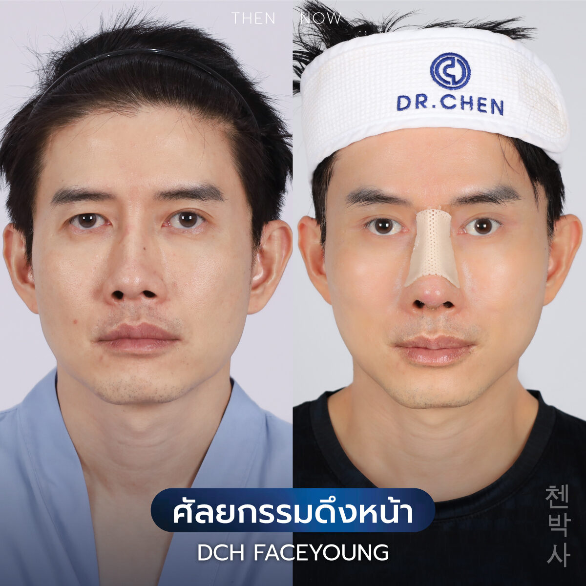 ดึงหน้าผู้ชาย