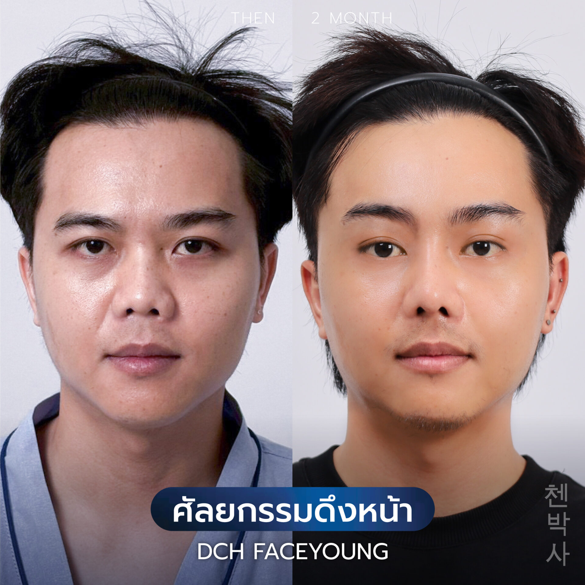 ดึงหน้าผู้ชาย