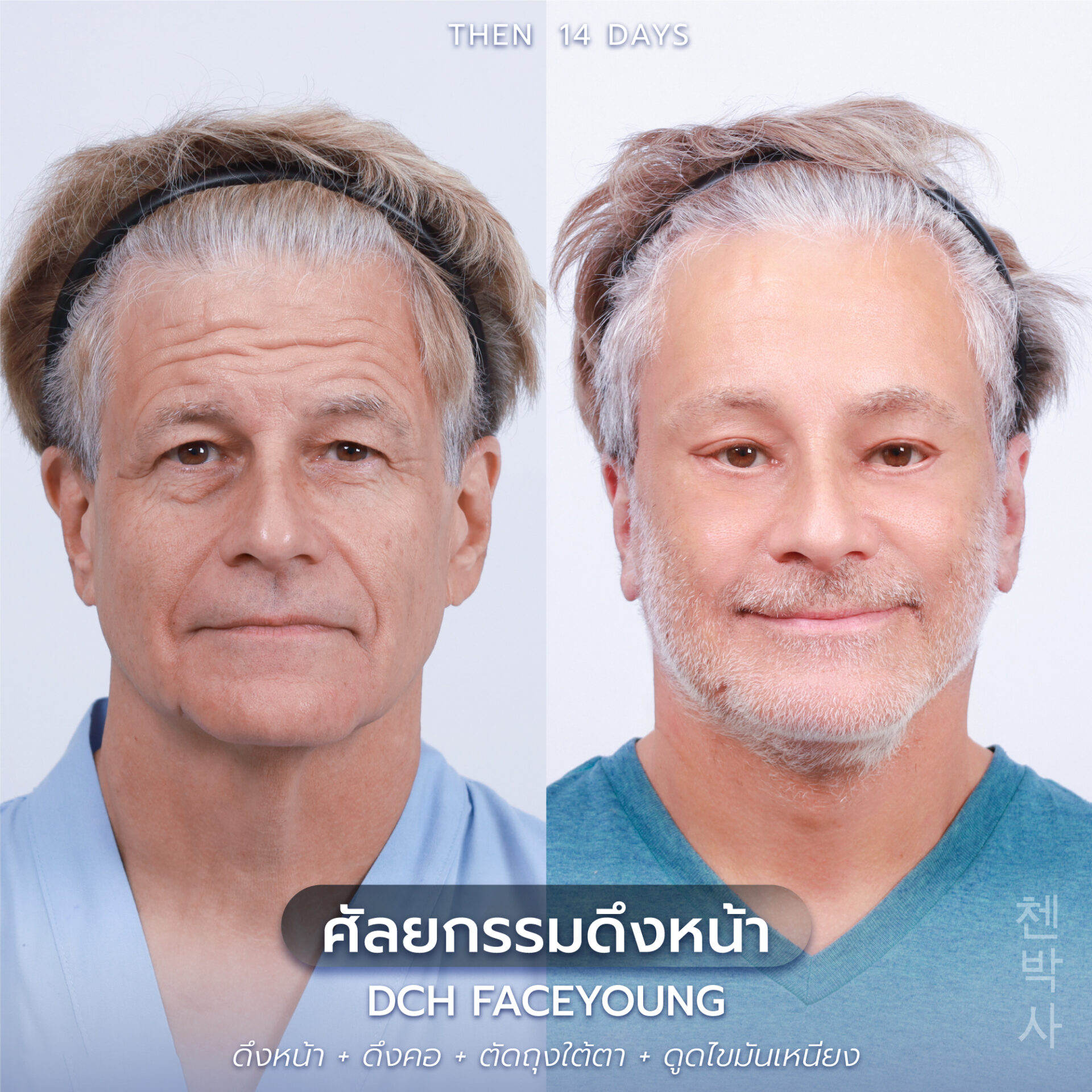 ดึงหน้าผู้ชาย