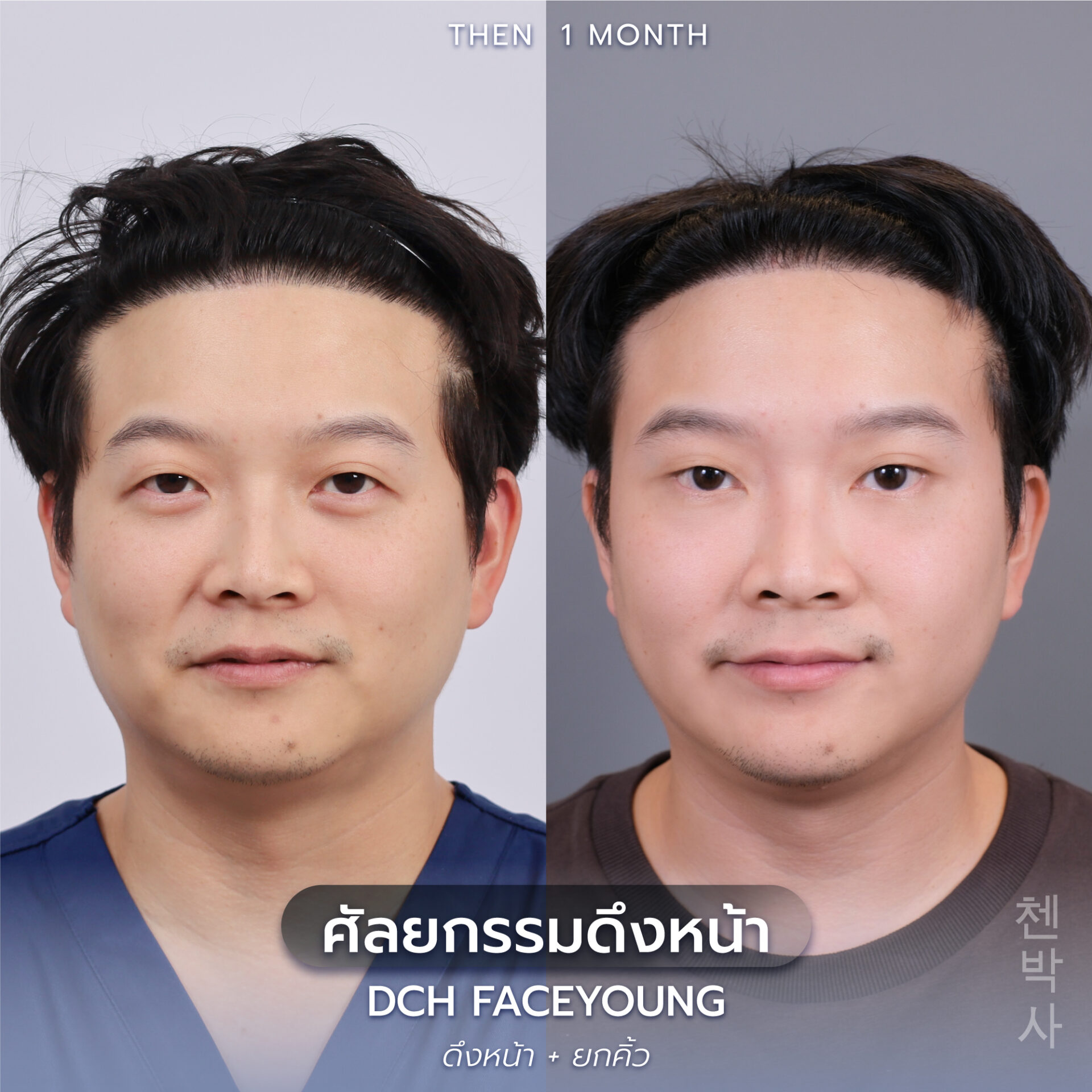 ดึงหน้าผู้ชาย