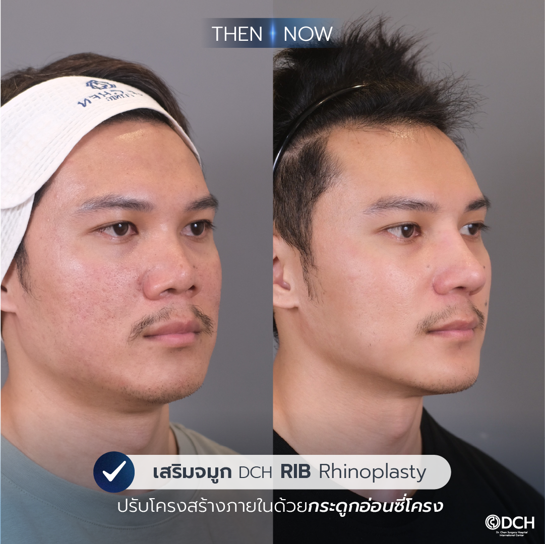 B-Aคุณเเทน 1_0