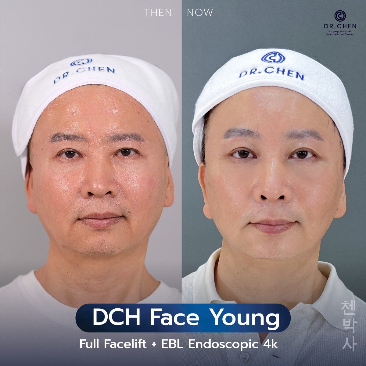 ดึงหน้าผู้ชาย