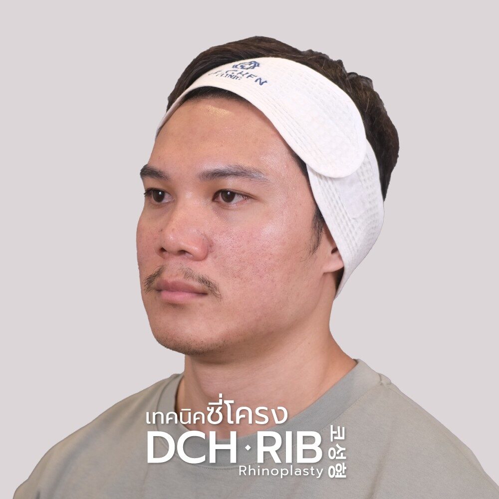 Rhinoplasty-Nose-manB-A33