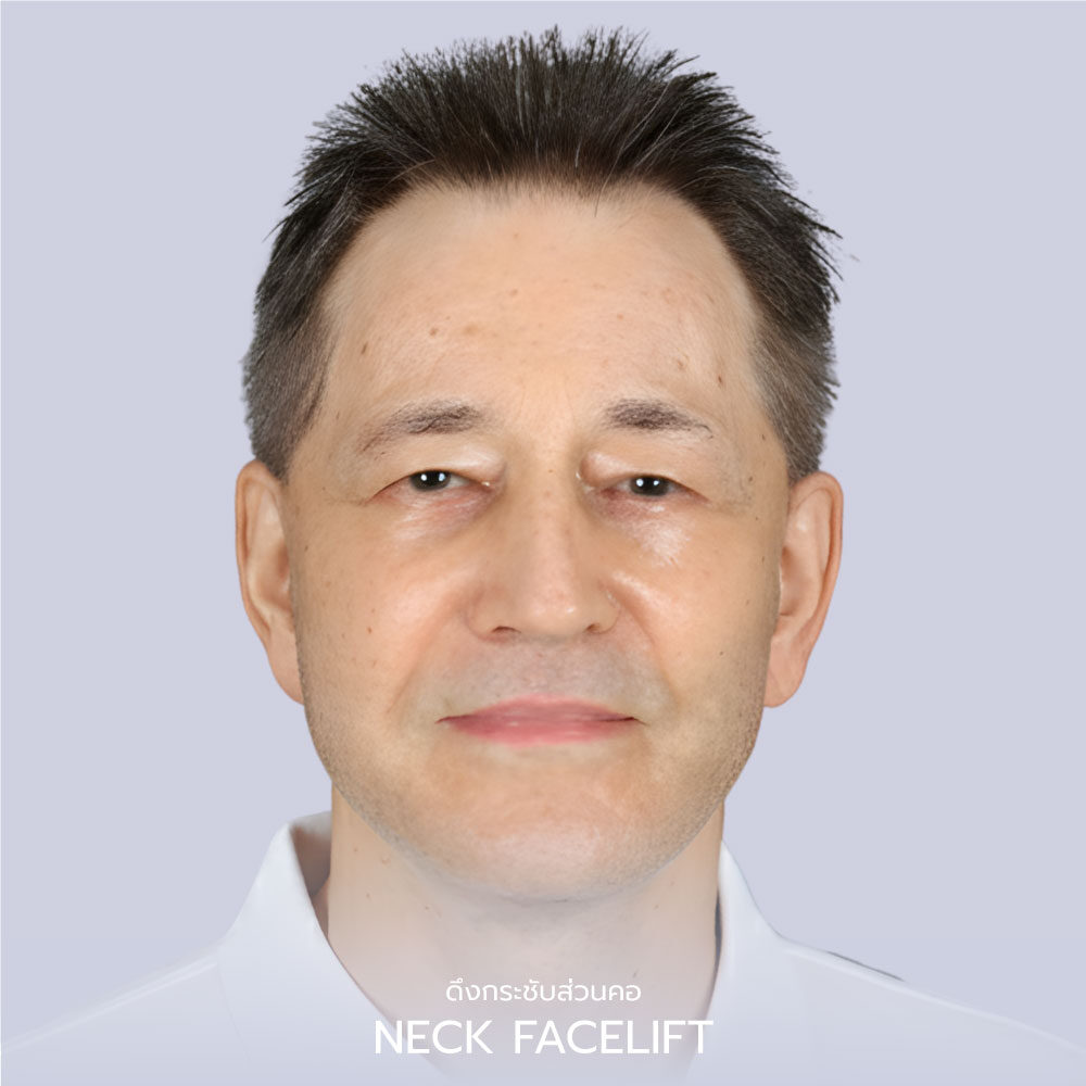 Necklift