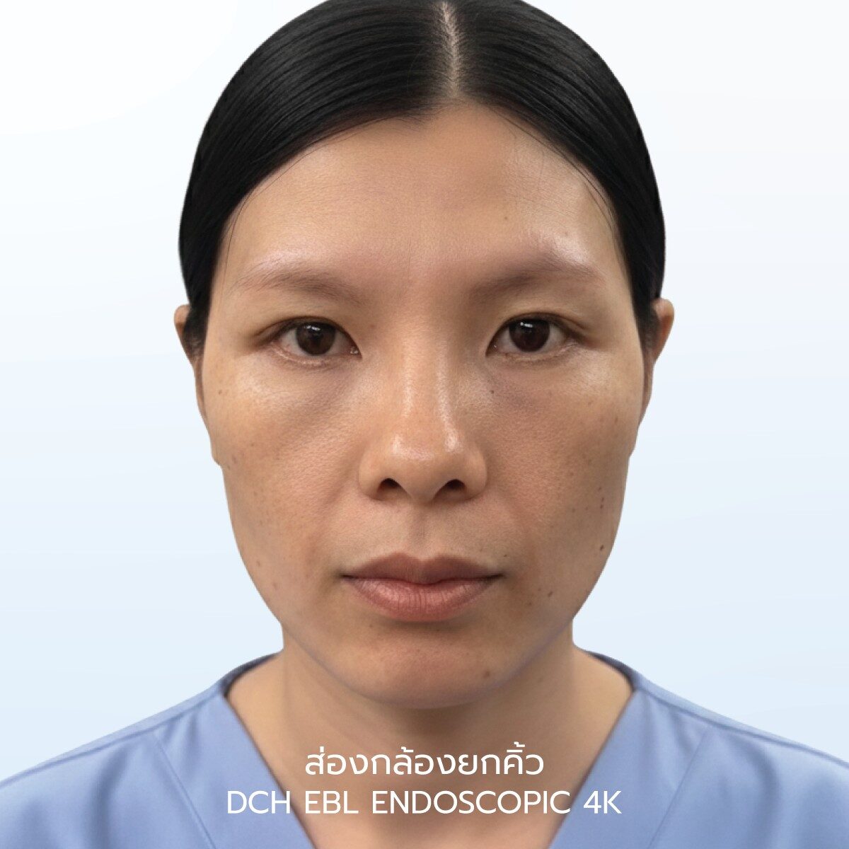 ยกคิ้ว EBL