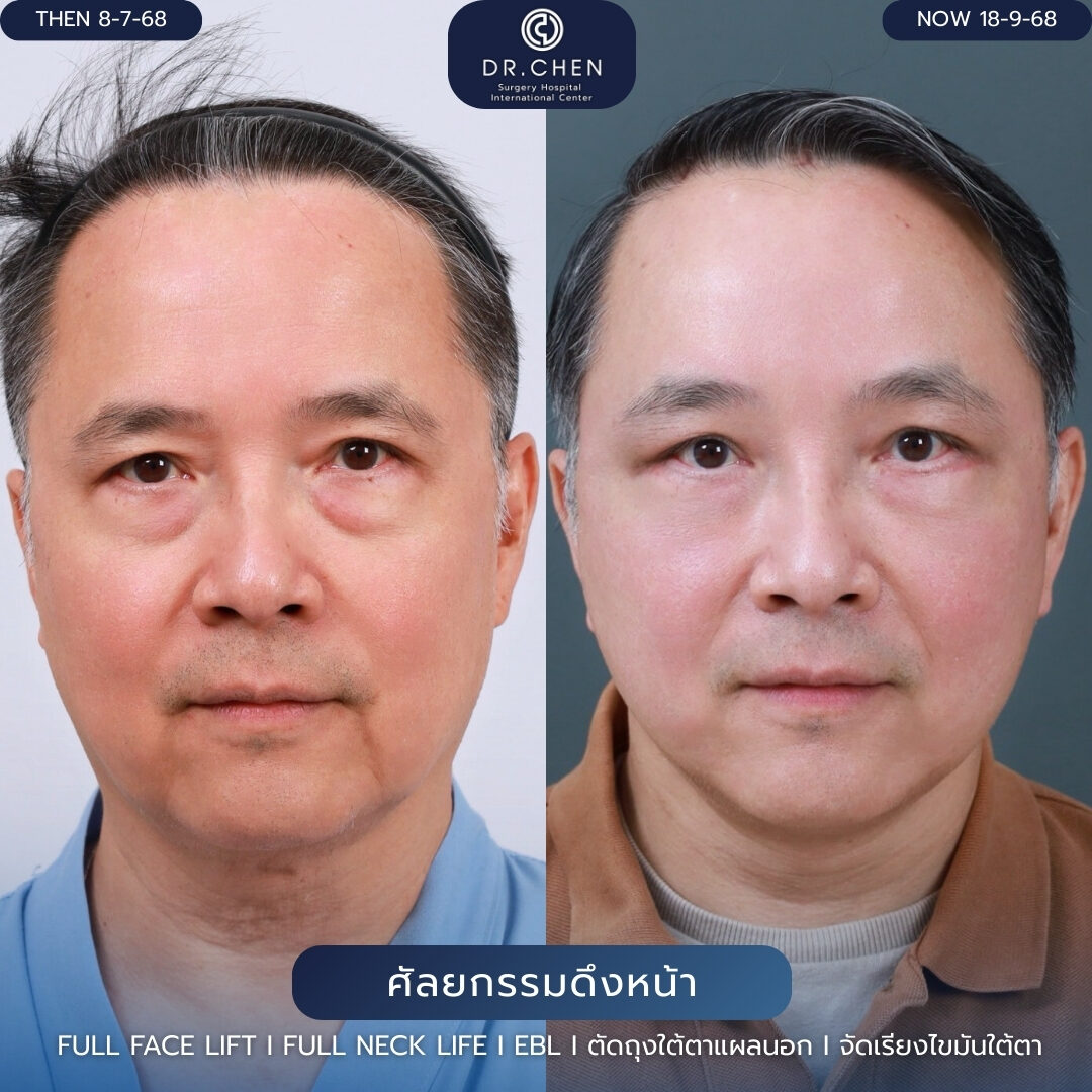 ดึงหน้าผู้ชาย