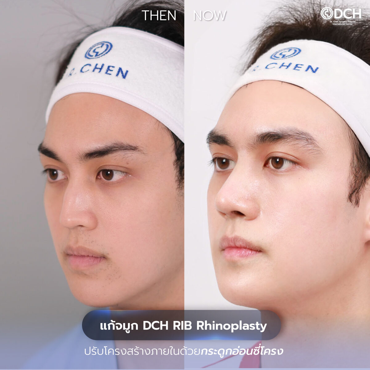 รีวิวจมูก-B-A-กอเกียร์_0