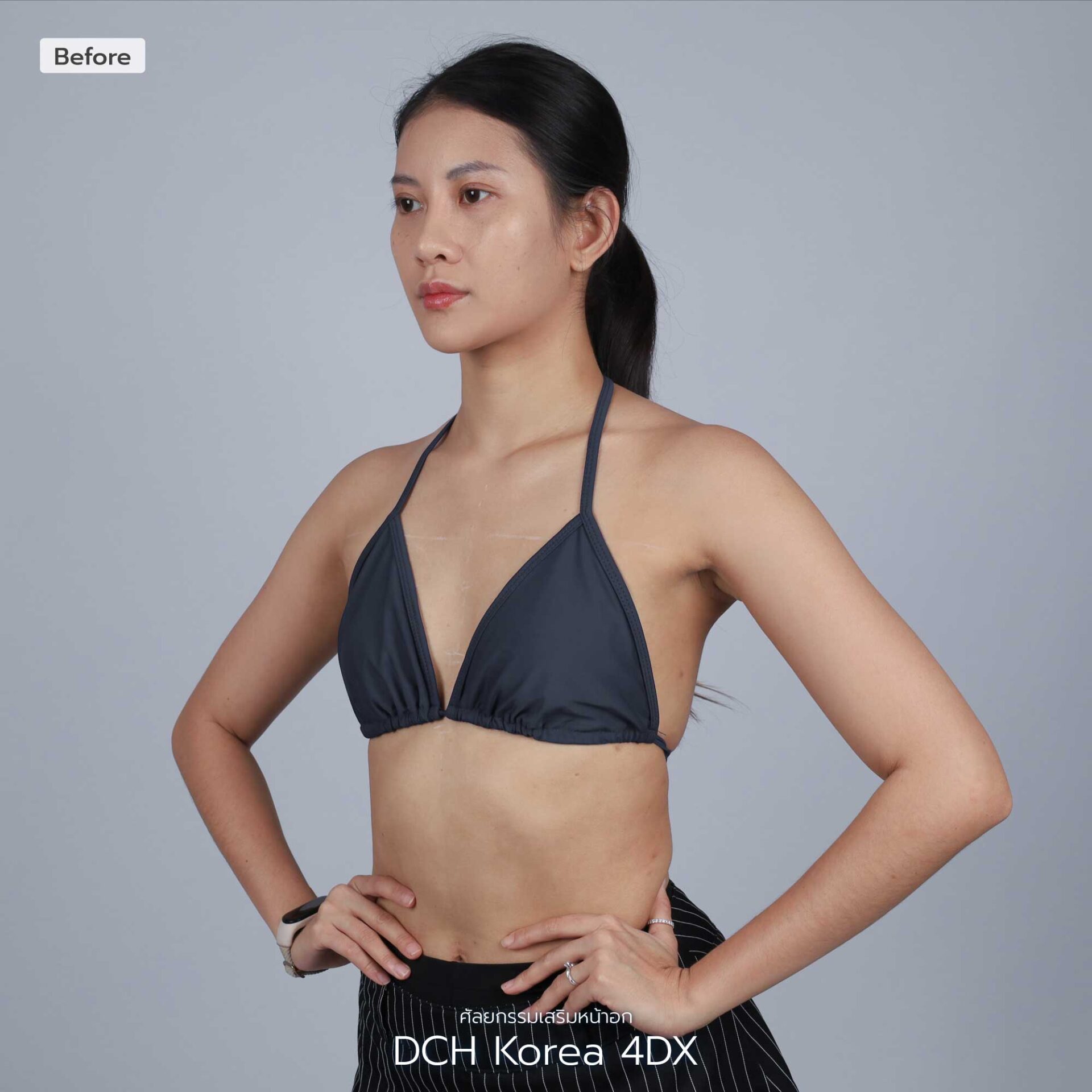 หน้าอก-เทียบภาพ-Web-โมจิ-01_0