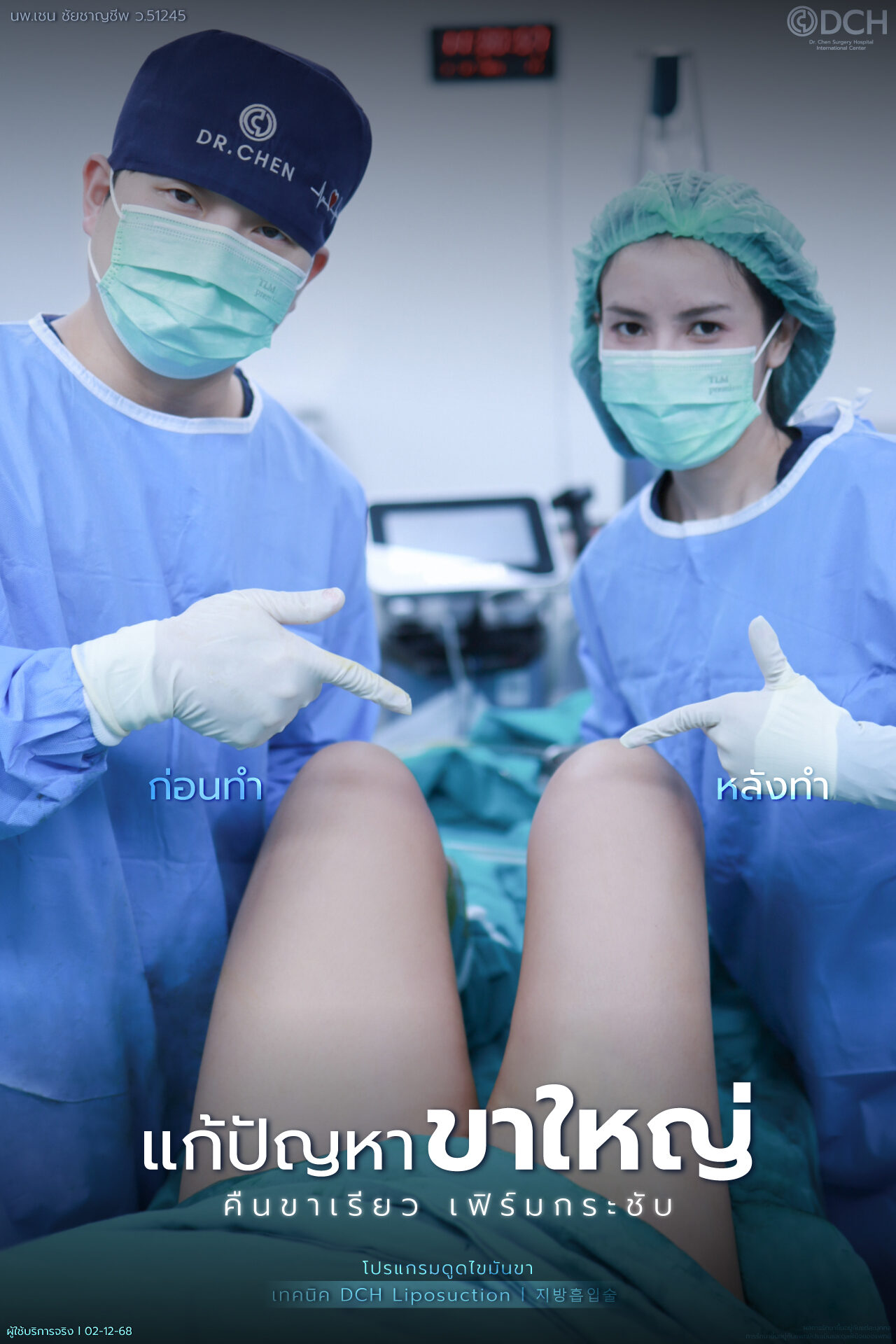 ทีมแพทย์ DCH ในห้องผ่าตัดชี้เปรียบเทียบต้นขาก่อนและหลังดูดไขมันต้นขาทันที