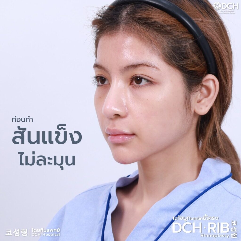 พส.จีน