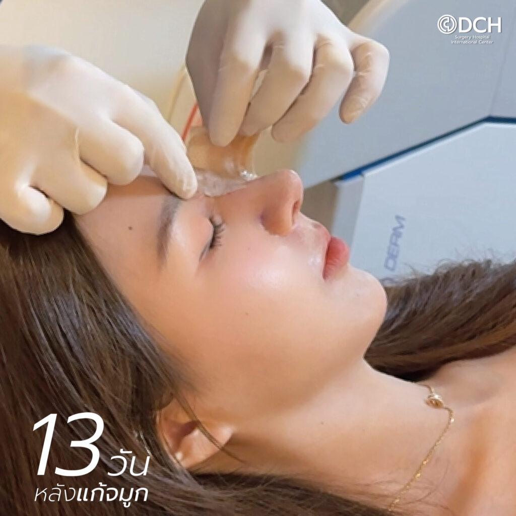 ลูกสาวหมอเชนDCH