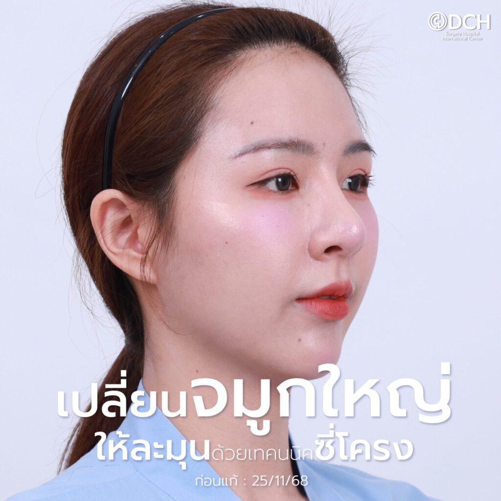 ลูกสาวหมอเชนDCH