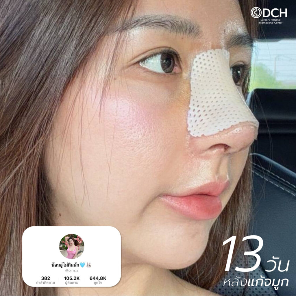 หมอเชนDCH