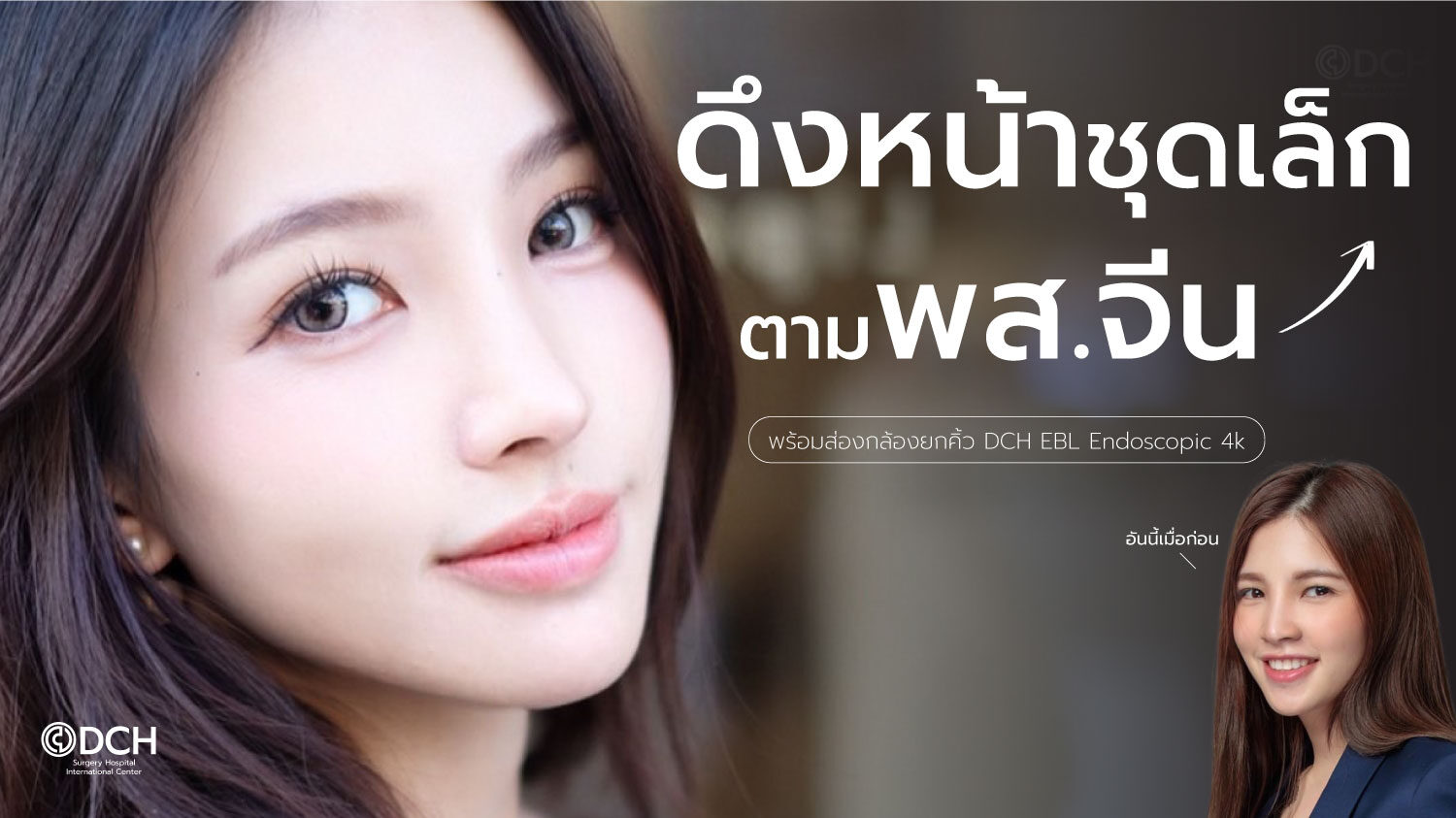ดึงหน้าพส.จีน