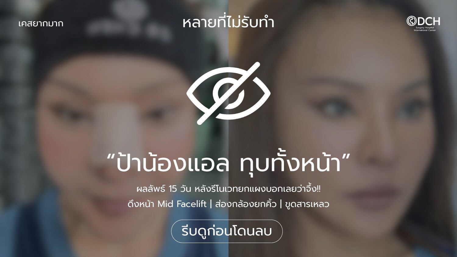 ป้าน้องแอล