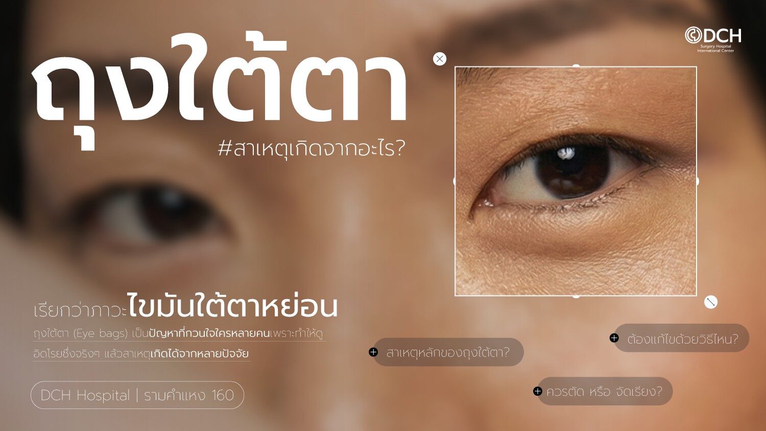 ถุงใต้ตา