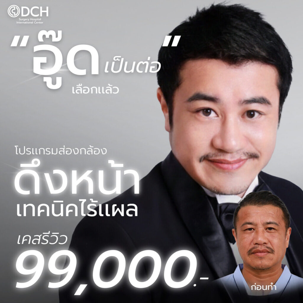 ดึงหน้า