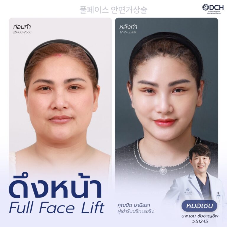 ดึงหน้า