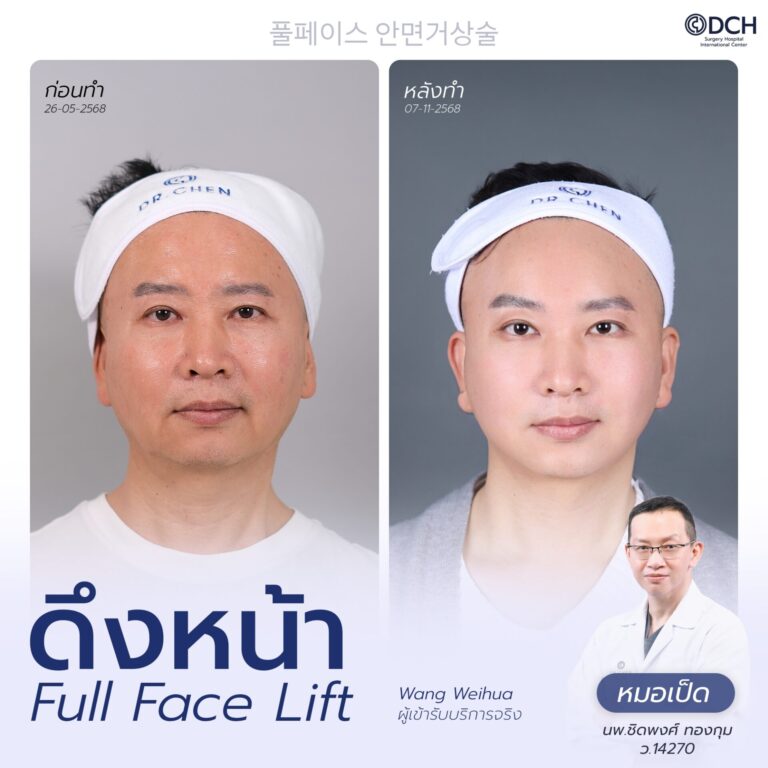 ดึงหน้า