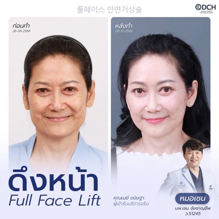 ดึงหน้า