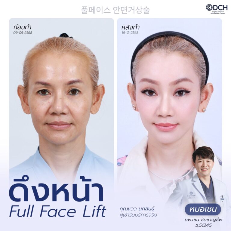 ดึงหน้า