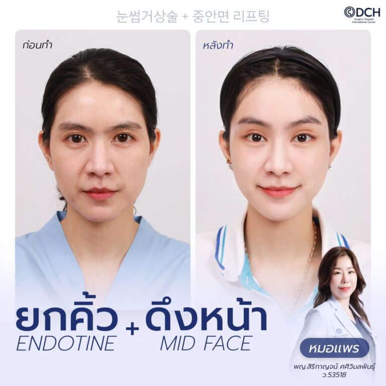 ยกคิ้ว EBL